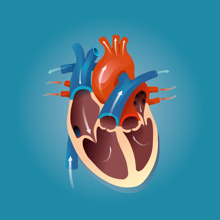 Hipopláziás bal szívfél szindróma (HLHS) | Gokvi